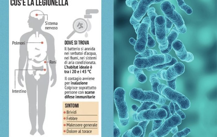 legionella